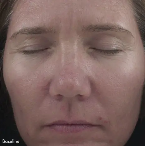 Obagi Retinol 1.0 Cream 28g_02.webp