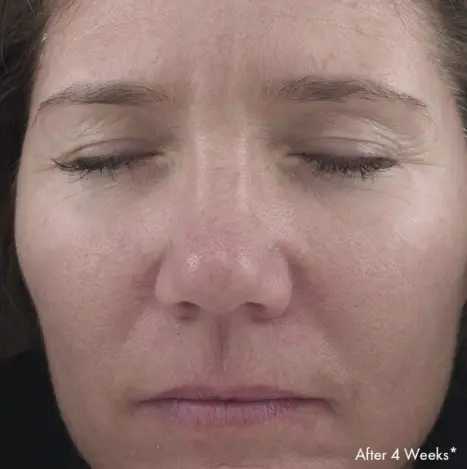 Obagi Retinol 1.0 Cream 28g_03.webp